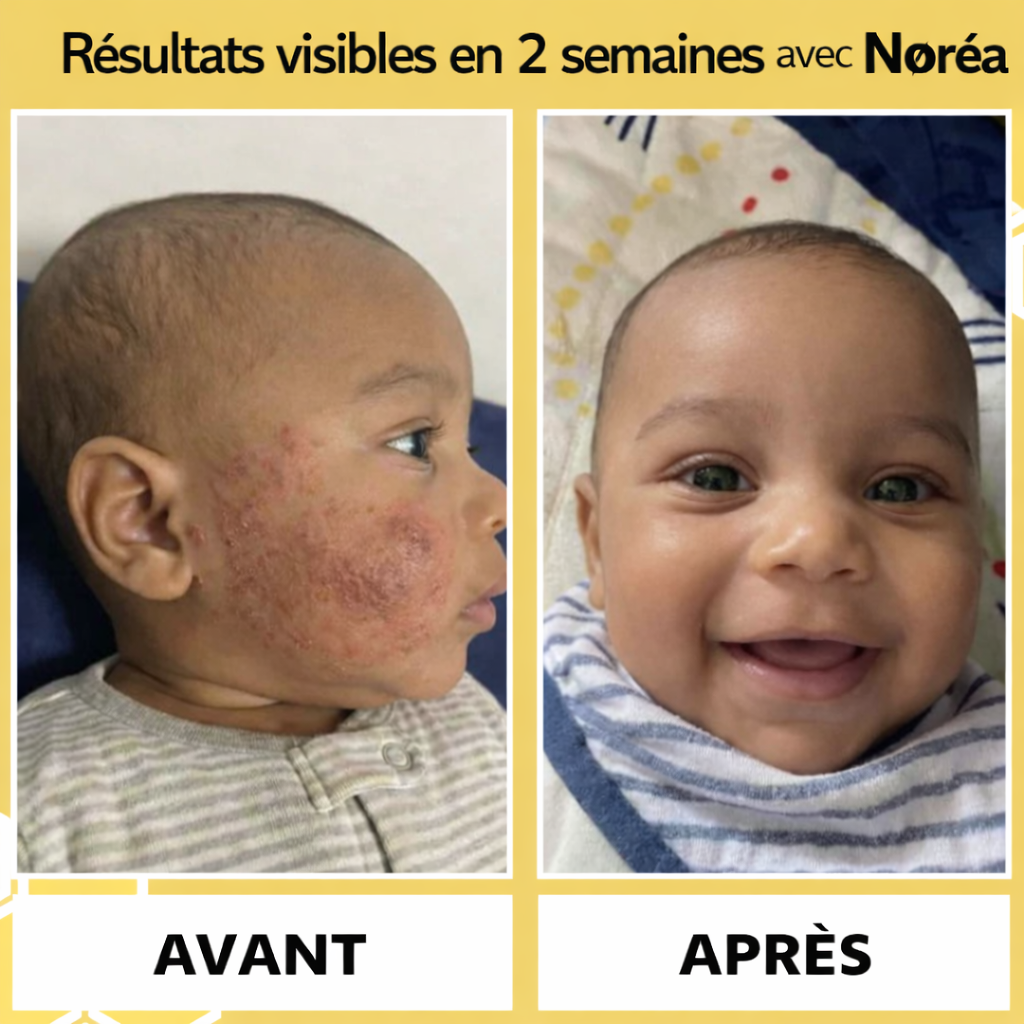 Crème Réparatrice Intense – Apaise Irritations & Rougeurs