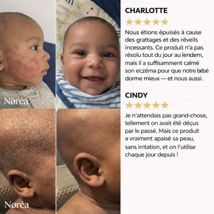 Crème Réparatrice Intense – Apaise Irritations & Rougeurs